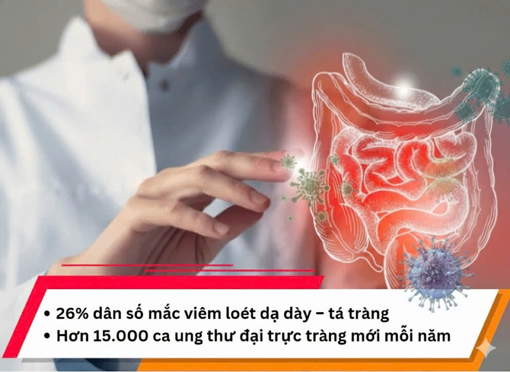 Thực trạng sức khỏe đường ruột đáng lo ngại hiện nay